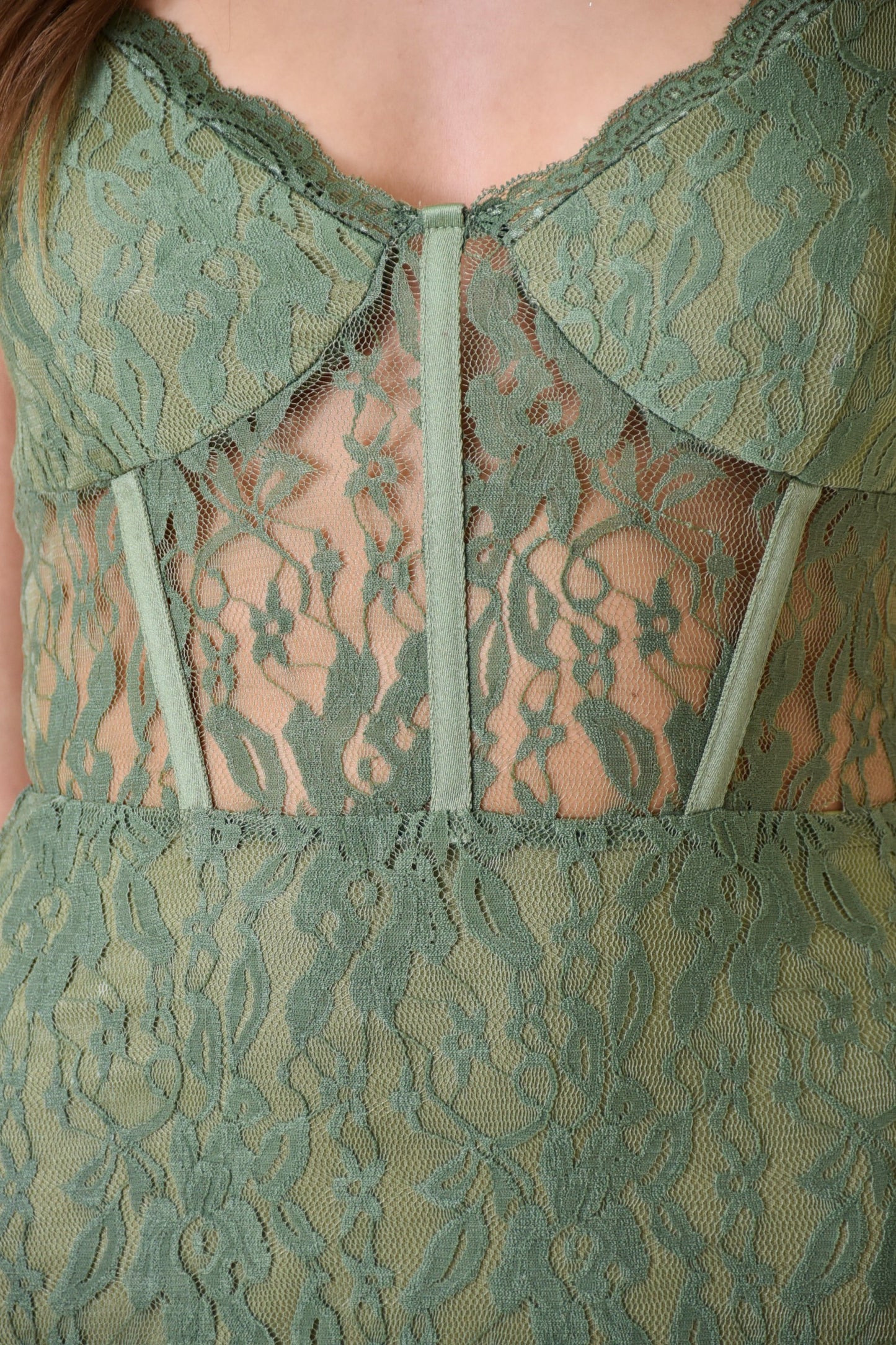 LACE DETAIL DRESS